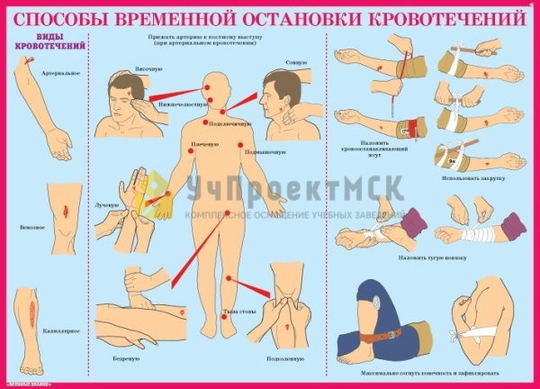 Комплект плакатов. Первая медицинская помощь (10л., 42х30см)